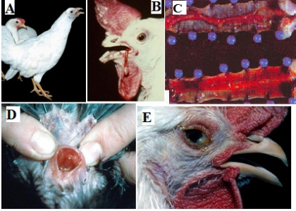 THÔNG TIN VỀ BỆNH VIÊM THANH KHÍ QUẢN TRUYỀN NHIỄM