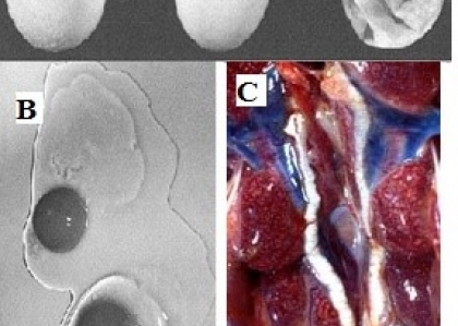 Thông tin về bệnh Viêm phế quản truyền nhiễm